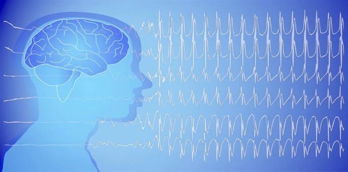 Epilepsi Hastalığı Hakkında Merak Ettikleriniz